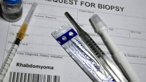 china biopsy device market
