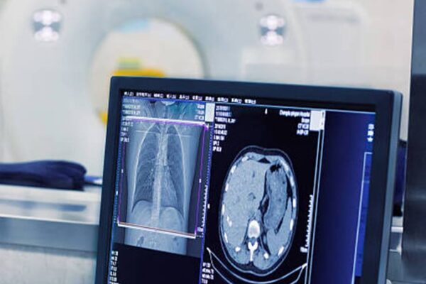 Experience Advanced Diagnostics with Chiropractic X-Ray Chiropractic x-ray