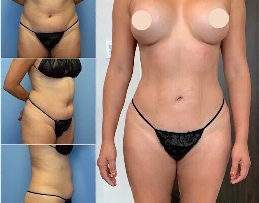 The Best Body Contouring Surgeons in Dubai Share Their Insights Body Contouring in dubai